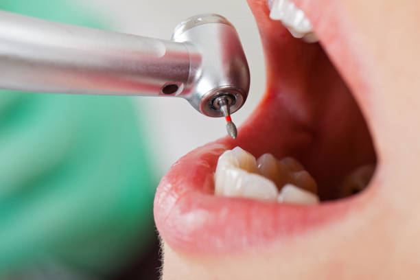 Best Emergency Treatment for Jaw Pain or Injury in Linda, CA